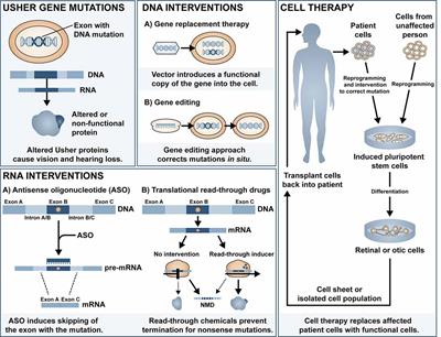 A Review of Gene, Drug and Cell-Based Therapies for Usher Syndrome
